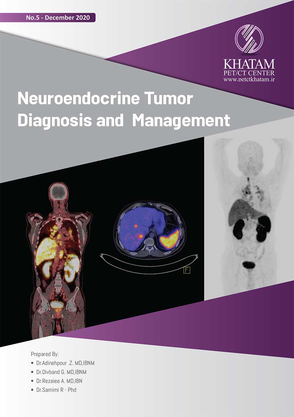 Neuroendocrine Tumor, Diagnosis and Management, No. 5, December 2020
